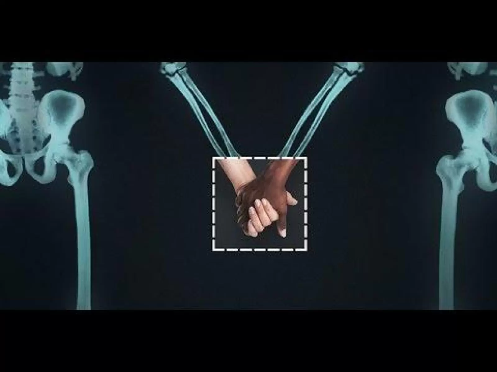 Diversidade & Inclusão - O amor não tem rótulos (Legendado PT/BR)