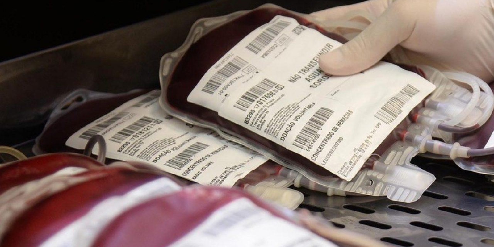 Brasil Desperdiça 18 Milhões De Litros De Sangue Ao Ano Por Preconceito